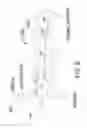 Fig. 07 - PERI-VASCULAR TISSUE ABLATION CATHETER WITH MECHANICAL SUPPORT STRUCTURES