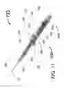 Fig. 10 - PERI-VASCULAR TISSUE ABLATION CATHETER WITH MECHANICAL SUPPORT STRUCTURES