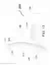 Fig. 12 - PERI-VASCULAR TISSUE ABLATION CATHETER WITH MECHANICAL SUPPORT STRUCTURES