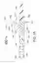 Fig. 14 - PERI-VASCULAR TISSUE ABLATION CATHETER WITH MECHANICAL SUPPORT STRUCTURES
