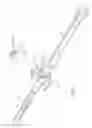 Fig. 02 - Cannula  Apparatus