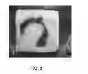 Fig. 03 - Hemostatic sponge