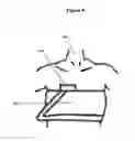 Fig. 07 - Breast wrap