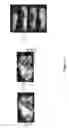 Fig. 13 - METHODS FOR DRUG DELIVERY