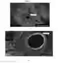 Fig. 14 - METHODS FOR DRUG DELIVERY