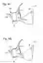 Fig. 05 - Apparatus and methods for compressing a woman's breast to express milk in a concealable manner