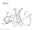 Fig. 07 - Apparatus and methods for compressing a woman's breast to express milk in a concealable manner