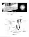 Fig. 09 - FATIGUE DAMAGE RESISTANT WIRE AND METHOD OF PRODUCTION THEREOF