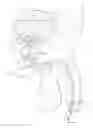 Fig. 01 - Catheter