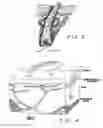 Fig. 04 - Method and apparatus for treating subcutaneous histological features