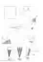 Fig. 02 - Electrosurgical instrument comprising a light guide