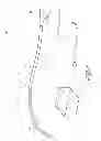 Fig. 02 - Systems for treating a hollow anatomical structure
