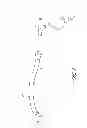 Fig. 03 - Systems for treating a hollow anatomical structure