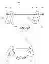Fig. 34 - Systems for treating a hollow anatomical structure