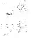 Fig. 37 - Systems for treating a hollow anatomical structure
