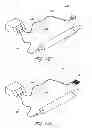 Fig. 40 - Systems for treating a hollow anatomical structure