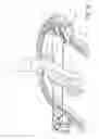 Fig. 03 - Dynamic external fixator and methods for use