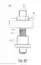 Fig. 06 - Dynamic external fixator and methods for use