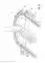 Fig. 15 - Dynamic external fixator and methods for use
