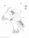 Fig. 17 - Dynamic external fixator and methods for use