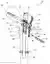 Fig. 01 - Implant system for bone fixation