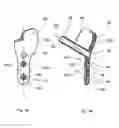 Fig. 05 - Implant system for bone fixation