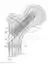 Fig. 01 - Bone fixation device
