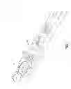 Fig. 08 - Modular fracture fixation system