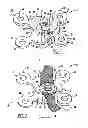 Fig. 02 - Locking mechanism to secure ends of an implantable band