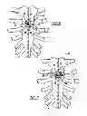 Fig. 05 - Locking mechanism to secure ends of an implantable band