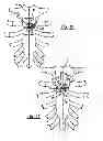 Fig. 06 - Locking mechanism to secure ends of an implantable band