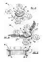 Fig. 08 - Locking mechanism to secure ends of an implantable band