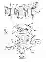 Fig. 10 - Locking mechanism to secure ends of an implantable band