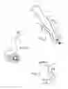 Fig. 02 - Minimally invasive device for surgical operations