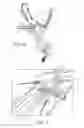 Fig. 04 - Minimally invasive device for surgical operations