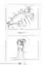Fig. 07 - Minimally invasive device for surgical operations