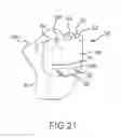 Fig. 35 - Arthroplasty jigs with mating accuracy