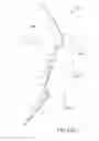 Fig. 43 - Arthroplasty jigs with mating accuracy