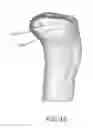 Fig. 65 - Arthroplasty jigs with mating accuracy