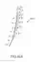Fig. 69 - Arthroplasty jigs with mating accuracy