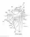 Fig. 76 - Arthroplasty jigs with mating accuracy