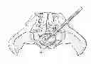 Fig. 01 - Cortical Rim-Supporting Interbody Device