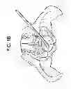 Fig. 03 - Cortical Rim-Supporting Interbody Device