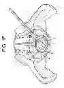 Fig. 07 - Cortical Rim-Supporting Interbody Device
