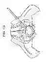 Fig. 08 - Cortical Rim-Supporting Interbody Device