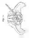 Fig. 09 - Cortical Rim-Supporting Interbody Device