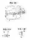 Fig. 17 - Cortical Rim-Supporting Interbody Device