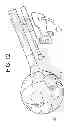 Fig. 18 - Cortical Rim-Supporting Interbody Device