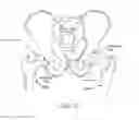 Fig. 03 - Method and apparatus for distracting a joint, including the provision and use of a novel fluid joint spacer