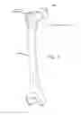 Fig. 04 - Method and apparatus for distracting a joint, including the provision and use of a novel fluid joint spacer